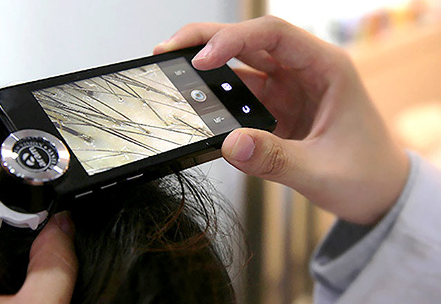 漢方による脱毛症研究 (脱毛症緩和効果の研究)